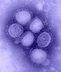 Thumbnail for Influenza A virus subtype H1N1