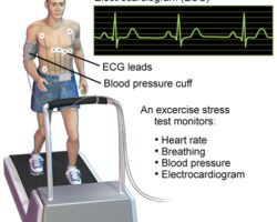 treadmill-ECG