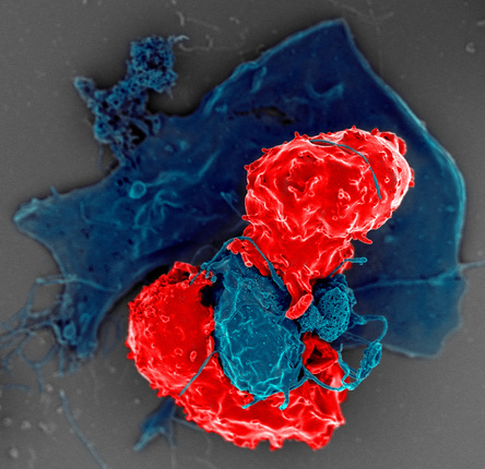 T Regulatory Cells. Scanning electron microscope image of T regulatory cells (red) interacting with antigen-presenting cells (blue). T regulatory cells can suppress responses by T cells to maintain homeostasis in the immune system.