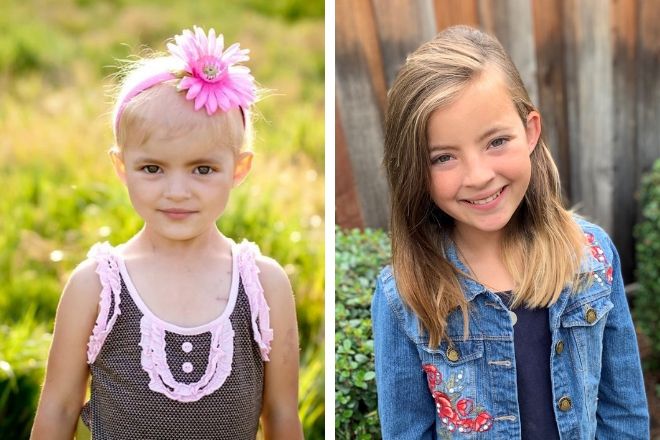 Gabriella Cosner was diagnosed at age 4 with rhabdomyosarcoma, a rare form of cancer. She received treatment at the Bass Childhood Cancer Center at Lucile Packard Children's Hospital Stanford.