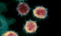 An electron microscope image of coronaviruses.