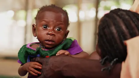 Baby Ummi at an MSF clinic