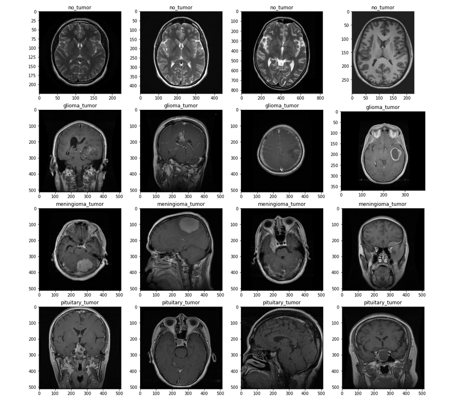 Brain-Tumor-Classification