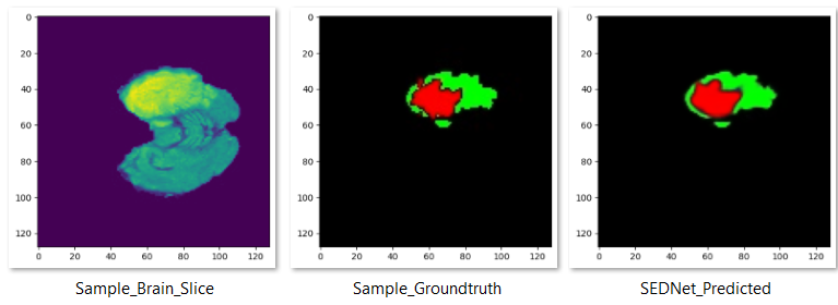 SEDNet_Shallow-Encoder-Decoder-Network-for-Brain-Tumor-Segmentation